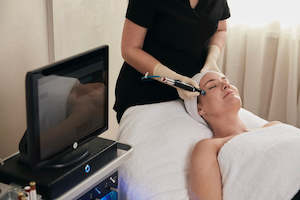 HydraFacial - Signature Treatment