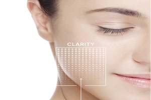 Treatments: Ultraceuticals Mandelic Acid Peel
