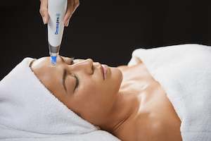 Acne Breakouts: Dermapen - Microneedling