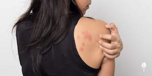 Caring for your biggest organ