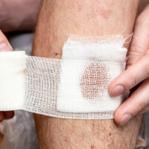 Early Care Service: Bacterial skin infections consultation