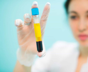 Products: PRP tubes - individual tubes AIMA Medical Limited