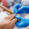 Treatments