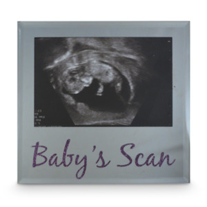 Landmark Baby's Scan Picture Frame