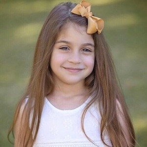 Bow Clips: Mustard bow clip - Medium