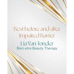 2025 JUVENATE Awards Best Before & After Impaired Barrier ⋆ Bien-être Beauty Therapy