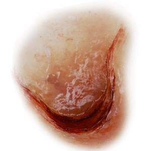 Silicone Mould- Hook Cut