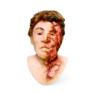Luke Burned - SimMan Facial Overlay