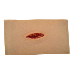 Wrap Around: Small Laceration