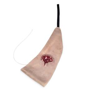 Wrap Around: Scapular Gun Shot Wound (New)