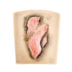 Wrap Around: Small Fire burn