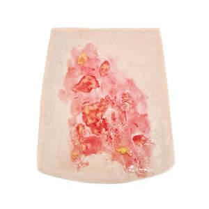 Wrap Around: Scalding Burn