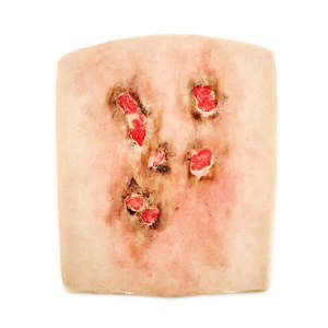 Wrap Around: Fire Burn