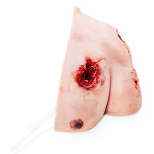 Trauma Wound Packing Shoulder