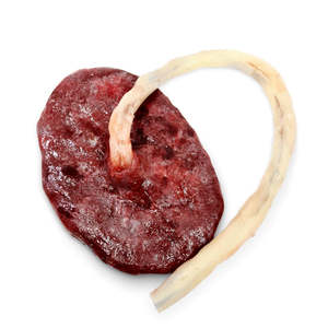 Placenta And Umbilical Cord