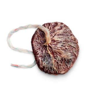 Skills Trainers: Full Term Placenta And Umbilical Cord