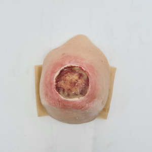 Library: SKILLS - Skin and wound care tissue viability package