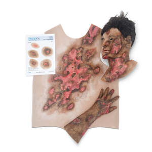 Library: SIM - Burns package