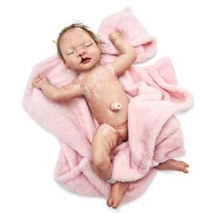 Baby Nina with cleft lip