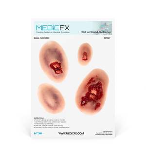 Sheet Small Fractures