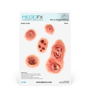 20 Clinical Stick On Moulage Sheets: Sheet Diabetic Ulcers