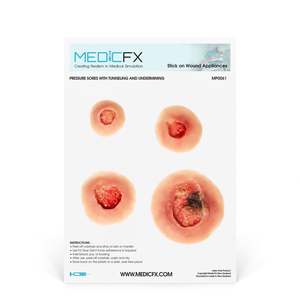 20 Clinical Stick On Moulage Sheets: Sheet Pressure Sores Cleanable