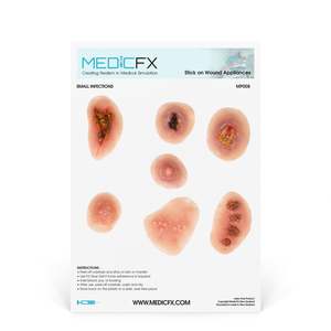 20 Clinical Stick On Moulage Sheets: Sheet Small Infections