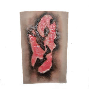 22 Wrap Around Burns: Large Burn