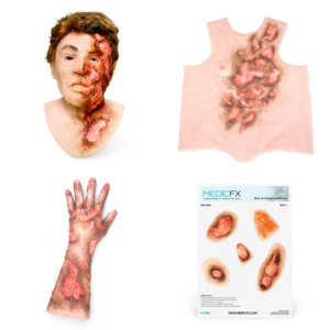 24 Multi Pack Burns: Burn Patient