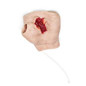 Perforating Left Hand Gun Shot Wound (New)