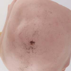 32 Skins Membranes Tissue Consumables: Belly skins