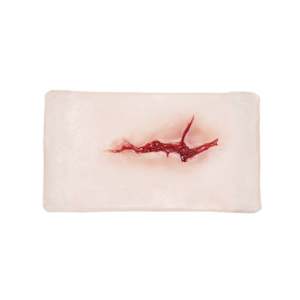 Large Laceration