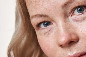 Skin Health Maintenance Plan Level 1