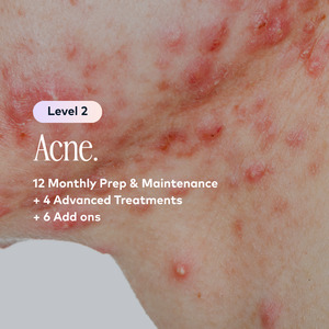 Acne Membership: Acne Level 2 Plan