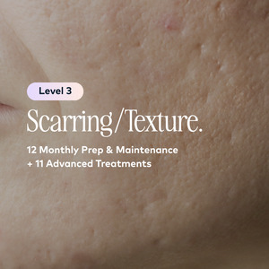 Scarring/ Texture Level 3