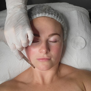 Advanced Skin 1 with Dermaplaning – 1-day Masterclass NZ Beauty Academy