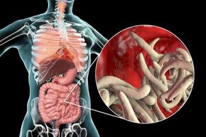Functional Tests: Faecal Parasites Test