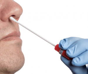 Functional Tests: Nasal Bacterial & Fungal Culture