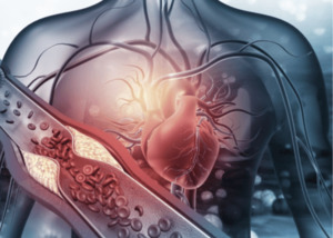 Functional Tests: Cardiovascular Profile
