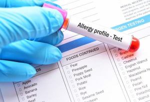 Functional Tests: IgG Delayed Reaction (96 Foods) blood draw