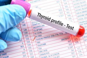 Functional Tests: Thyroid Profile Basic