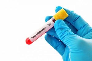 Functional Tests: The Most Comprehensive Intolerance Test for 200 Food/Herbs/Antibiotics/Mould/Additives Platinum