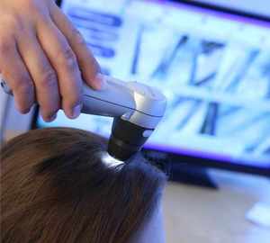 Products: Scalp Analysis Only Connect Healing