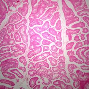 Microscope Slide – Spermatogenesis (Rabbit Testis)