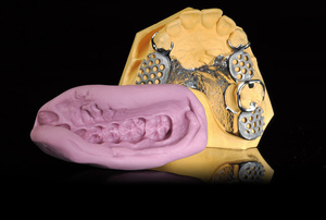 Products: SheraDuplica-Hard 95 Silicone Putty (2 x 1.5Kg)