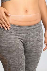 Scar Management: Amoena Squares Silicone Scar Patch