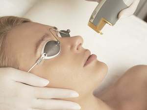Laser Genesis Skin Rejuvenation Full Face