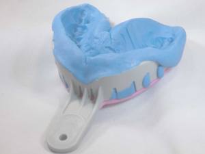 Products: Impression Kit