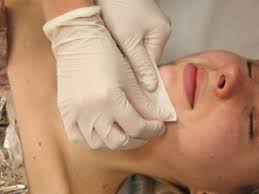 Chin - Gloucester Cottage