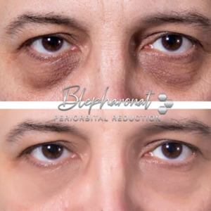 Products: Blepharobright Mystic Beauty